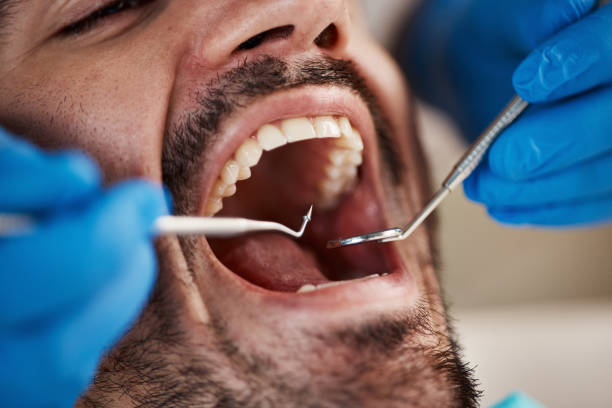 Best Urgent Dental Care for Toothache in Granvle, IL
