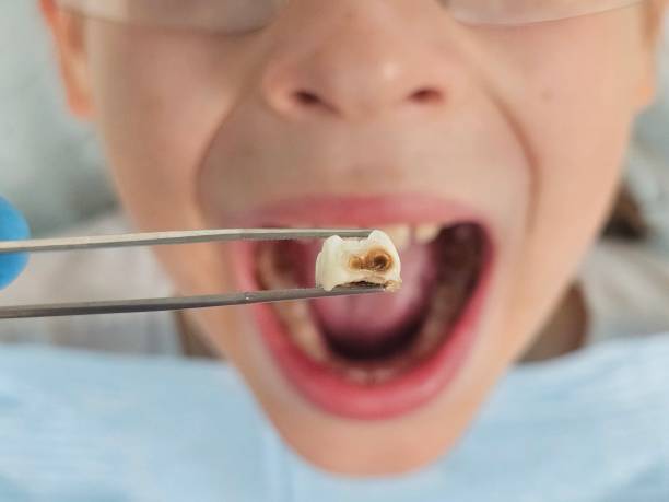 Best Mobile Emergency Dentist in Granvle, IL