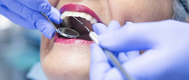 Best Emergency Root Canal Treatment in Granvle, IL