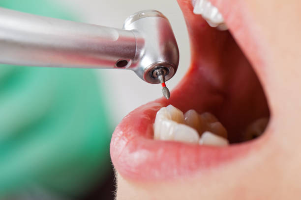 Best Broken or Cracked Tooth Emergency Dentist in Granvle, IL